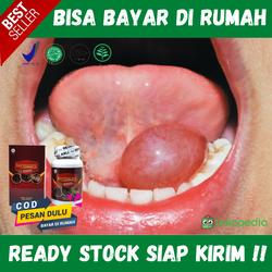 Jual Benjolan Di Bawah Lidah Murah Harga Terbaru November 2021