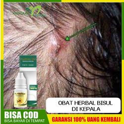 Jual Bisul Di Kepala Murah Harga Terbaru November 2021