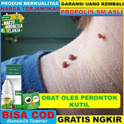 Jual Obat Kutil Di Leher Di Apotik Murah Harga Terbaru November 2021