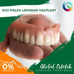 Jual Gigi Palsu Lepasan Terbaik Terbaru May 2021 Harga Murah