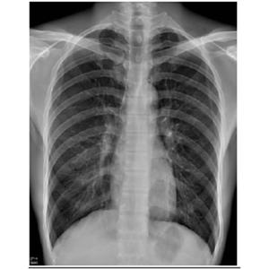 Harga medical dry film radiology blue inkjet film ukuran | spotharga.com Harga medical dry film radiology blue inkjet film ukuran | spotharga.com
