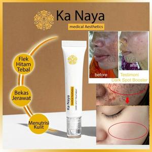 Katalog Masker Flek Hitam Katalog.or.id Katalog Masker Flek Hitam Katalog.or.id