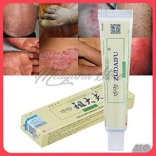 Foto Produk Salep Herbal Untuk Psoriasis Dermatitis Dan Eczema Pruritus dari Meliyana Store