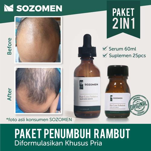 Foto Produk Paket Komplit dari Sozomen
