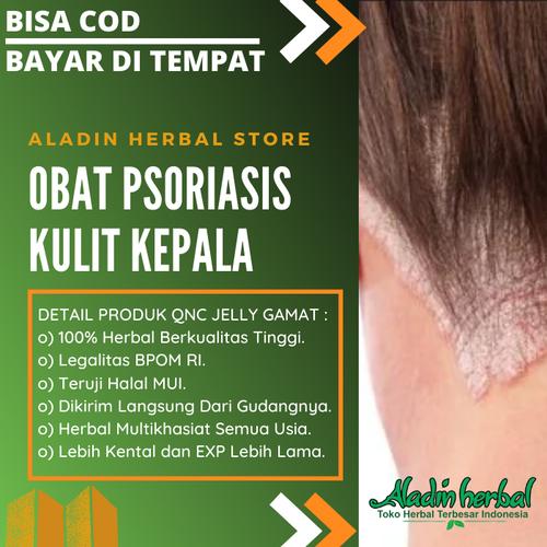Jual Obat Psoriasis Kulit Kepala Eksim Menahun Ketombe Kulit Bersisik Kota Bekasi Aladin Herbal Bekasi Tokopedia