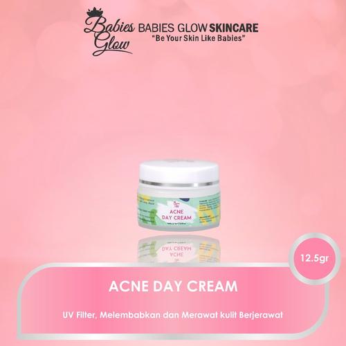 Foto Produk Acne Day Cream New dari BabiesGlowAesthetic