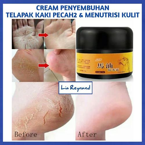 Foto Produk CREAM TELAPAK KAKI PECAH PECAH MENUTRISI KULIT DAN MENCERAHKAN KULIT dari Liya Reynand