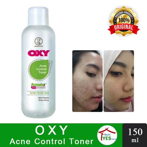 oxy acne control toner