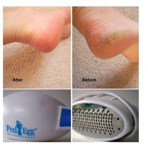 Foto Produk Ped Egg Alat Penghalus Pembersih Tumit Kaki Kasar Kering Pecah Kapalan dari Aneka Grosir Dhamira