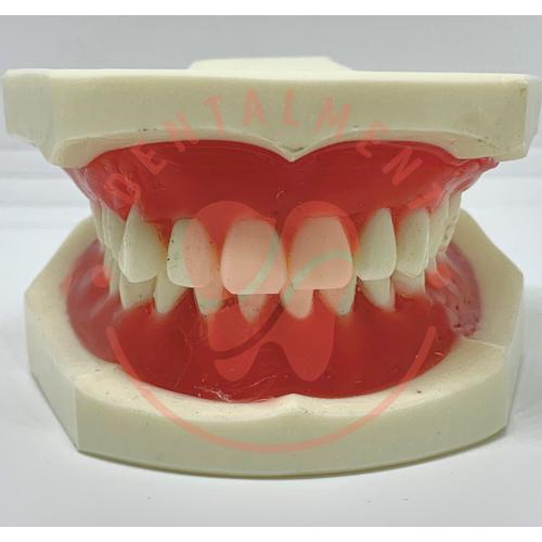 Modello Dentale Ortodontico Typodont 1:1 Con Staffe – Dimostrativo Per Studio E Laboratorio