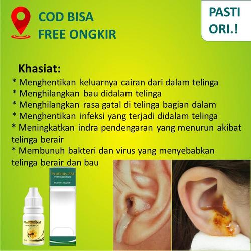 Jual Obat Untuk Congek Telinga Berair Dan Bau Curek Keluar Nanah Alami Kota Surabaya Riswan Herbal Surabaya Tokopedia