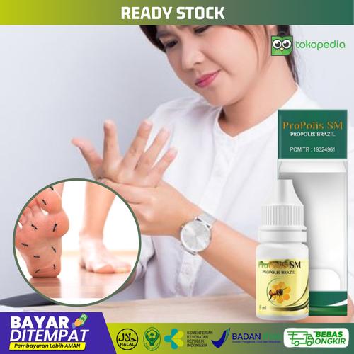 Jual Obat Herbal Sering Kebas Kesemutan Kaku Jari Tangan Kaki Kram Kab Bekasi Qnc Jelly Gamat Original Tokopedia