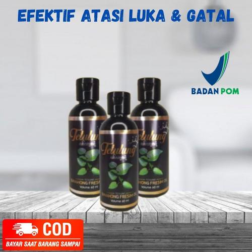 Foto Produk TETULUNG FRESIM OBAT ATASI EKSIM BASAH DAN KERING dari Beauty Herball