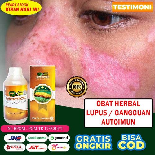 Foto Produk Obat Lupus / Autoimun Herbal Qnc Jelly Gamat 100% Asli Alami Testimoni dari Dijeksi Herbal