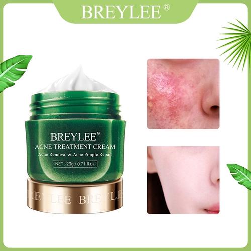 Foto Produk Breylee Krim Penghilang Jerawat Komedo Cream Wajah Pengecil Pori Pori dari Bursa Cosmetik Murah