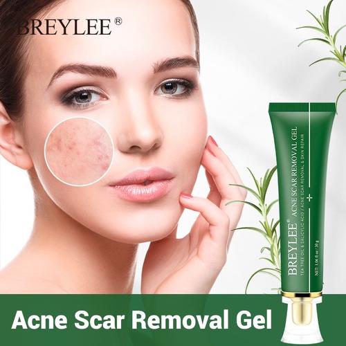 Foto Produk Breylee Gel Penghapusan Jerawat Bekas Luka Pemutih Kulit 30g Acne Scar dari Bursa Cosmetik Murah
