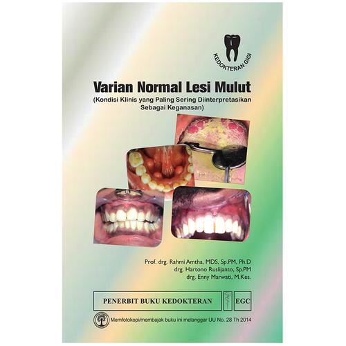 Gambar Buku Varian Normal Lesi Mulut dari Dental ID Store Kab. Sleman Tokopedia