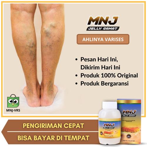 Gambar Obat Varises Berkhasiat MNJ Jelly Gamat dari Toko Acep Herbals Jakarta Pusat Tokopedia