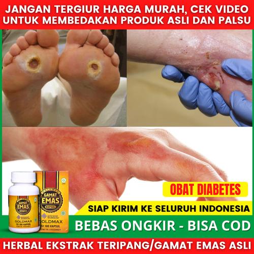 Foto Produk Obat Khusus Diabetes Walatra Gamat Emas Kapsul Gold Max Real Testimoni dari Toko Acep Herbals
