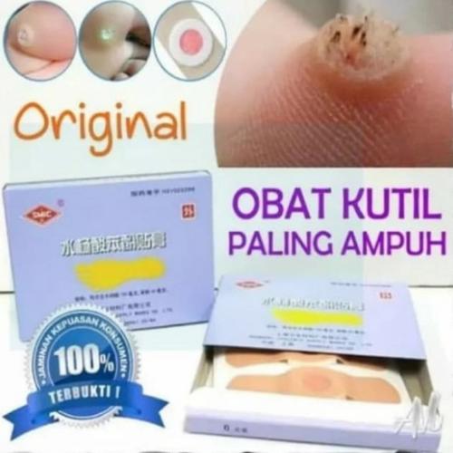 Gambar plester obat kutil mata ikan kapalan ji yan gao dari syihabvadia Kota Depok Tokopedia