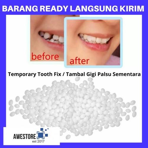 Foto Produk DIY Temporary Tooth Repair Kit Denture Teeth Lem Gigi Palsu Tambal - 5 Gram dari Awestore2017