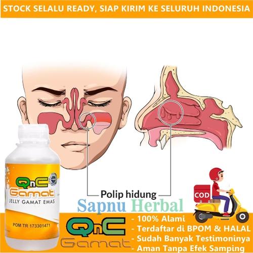 Gambar Pengobatan Polip Hidung Secara Alami dengan Herbal QnC Gamat (PH) dari Toko Herbal Ardian Kab. Bekasi Tokopedia