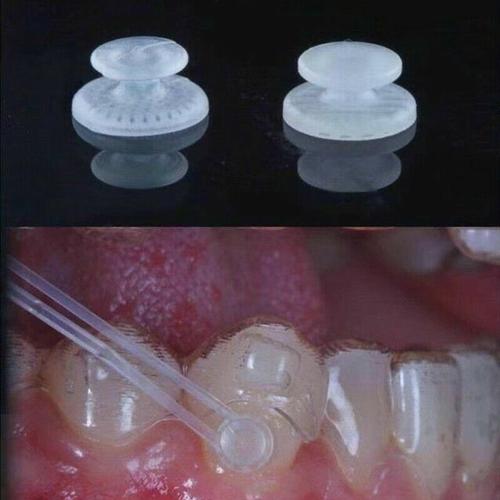 Jual Lingual Button Composite Round / Dental Lingual Button Clear isi ...