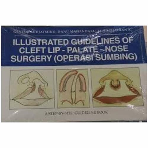 Jual ILLUSTRATED GUIDELINES OF CLEFT LIP - PALATE - NOSE SURGERY ...