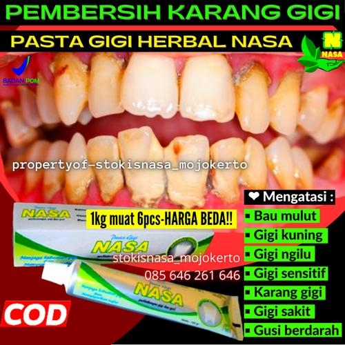 Jual Pasta Gigi Nasa Original Odol Nasa Penghilang Dan Perontok Karang Gigi Kota Mojokerto Stokis Nasa Center Jawa Timur Tokopedia
