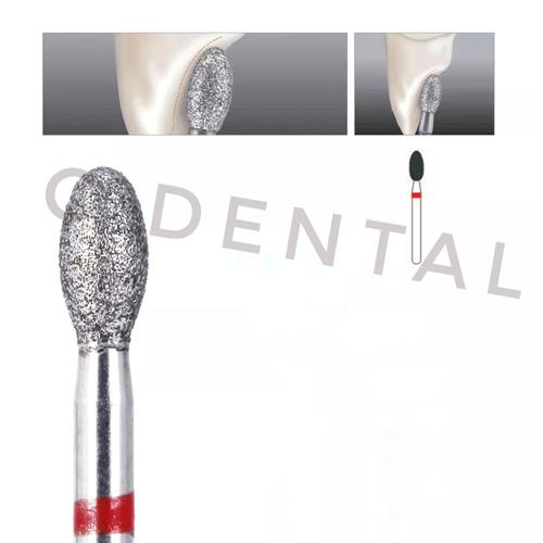 Jual Dental Egg Shape Diamond Bur Crown Veneer Palatal Reduction High