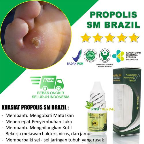 Jual Obat Salep Mata Ikan Di Telapak Kaki Herbal Propolis Sm Brazil Jakarta Timur Ripkiherbal Tokopedia