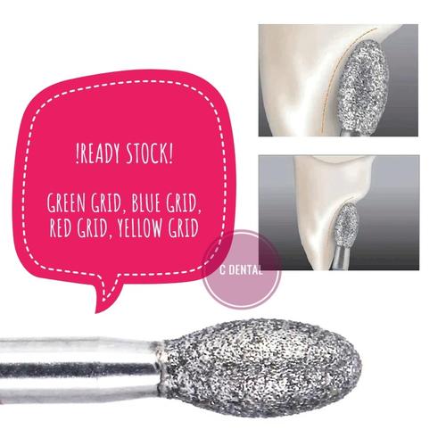 Jual Dental Egg Shape Diamond Bur Crown Veneer Palatal Reduction High