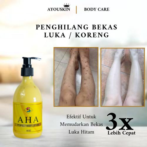 Lotion Menghilangkan Bekas Luka