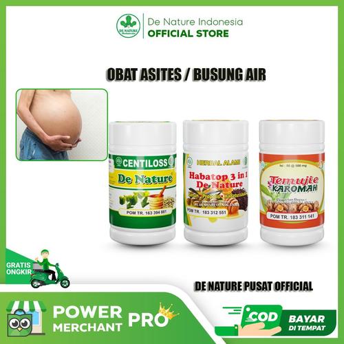 Jual Obat Penyakit Asites Ascites Busung Air Kelebihan cairan di perut ...
