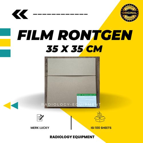 Jual FILM RADIOLOGI 35X35 CM - Kota Tangerang - Radiologi_Equipment ...