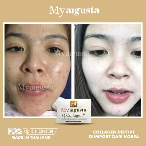 Foto Produk Q COLLAGEN MY AUGUSTA THAILAND / AUGUST DIETARY SUPPLEMENT dari Raja Kosmetik Murah