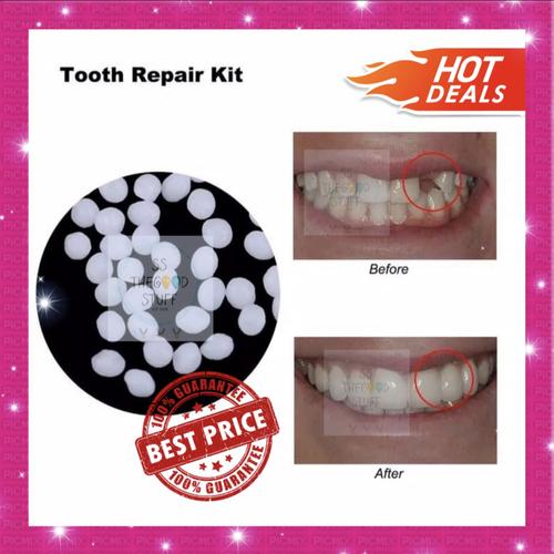 Foto Produk Temporary Tooth Repair Kit / Denture Adhesive / Lem Gigi / Gigi Palsu. dari SS TheGoodStuff