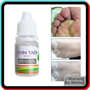 Gambar Skin Tag Remover - Obat Oles Kutil Mata Ikan & Tahi Lalat dari Warung Bu Nining Jakarta Timur Tokopedia