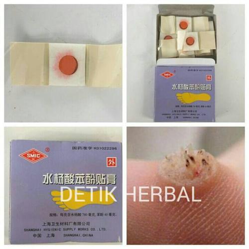 Foto Produk Ji Yan Gao ( Plester Kutil ) Mata Ikan ( Kapalan dari DETIK HERBAL