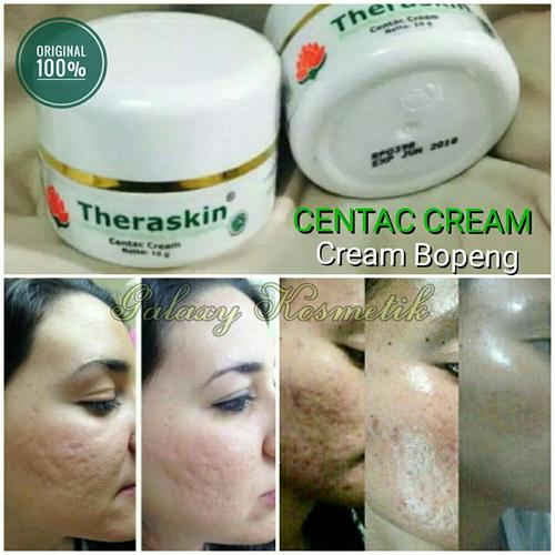 Jual Theraskin Centac Cream Original Penghilang Bopeng Bekas Jerawat Kota Bandung Galaxy Acc Tokopedia