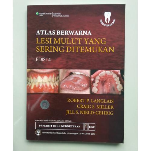 Gambar Buku Atlas Berwarna Lesi Mulut Sering Ditemukan Edisi 4 dari Dental ID Store Kab. Sleman Tokopedia