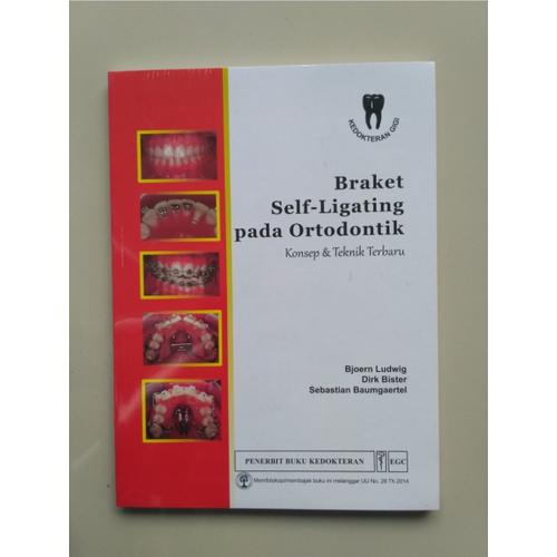 Gambar Buku Braket Self-Ligating pada Ortodontik dari Dental ID Store Kab. Sleman Tokopedia