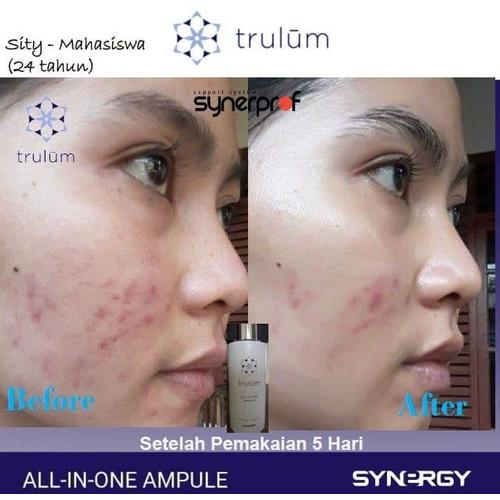 female daily erha skin care