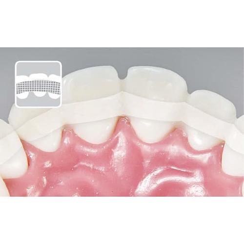 Jual Fiber splinting fiber splint dental 1 1mmx200mmx2 Kota