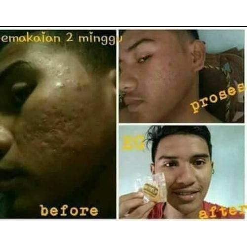 Jual Sabun Gove Sabun Herbal Pria Dan Wanita 1 Pcs Jakarta Selatan Sabun Gove Herbal Tokopedia