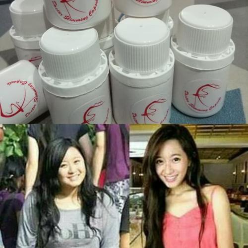 Foto Produk OBAT PELANGSING / OBAT KURUS DOKTER DIJAMIN BB TURUN DAN AMAN ALAMI ! dari nora makmur