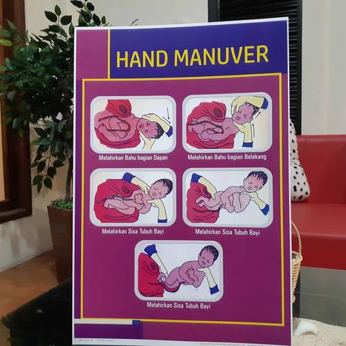 Foto Produk Poster Kebidanan : Hand Manuver dari Syafana