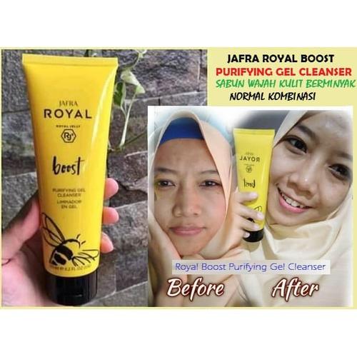 Jual Sabun Jerawat Sabun Muka Penghilang Jerawat Menghilangkan Bekasnya Jakarta Timur K Giant Tokopedia