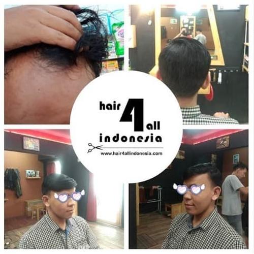 PU wig pria bukan wak doyok minoxidil vitamin rambut beard oil loreal di  Impormudahid Tokopedia