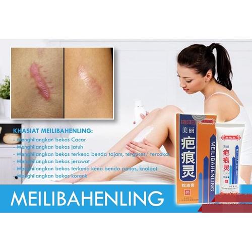 Foto Produk MeiLinbahenLing PenghiLang SegaLa Jenis Bekas Luka Di KuLit dari Chibi Shops